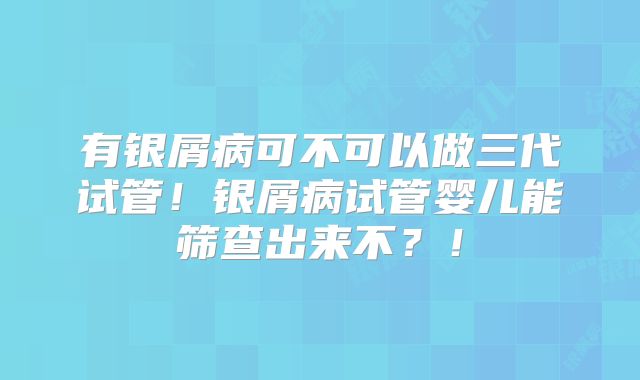 有银屑病可不可以做三代试管！银屑病试管婴儿能筛查出来不？！
