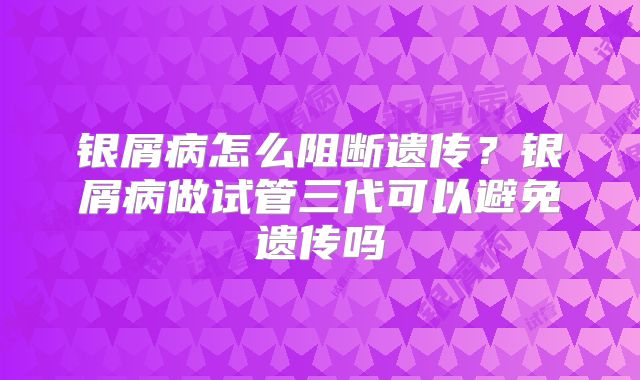 银屑病怎么阻断遗传?银屑病做试管三代可以避免遗传吗