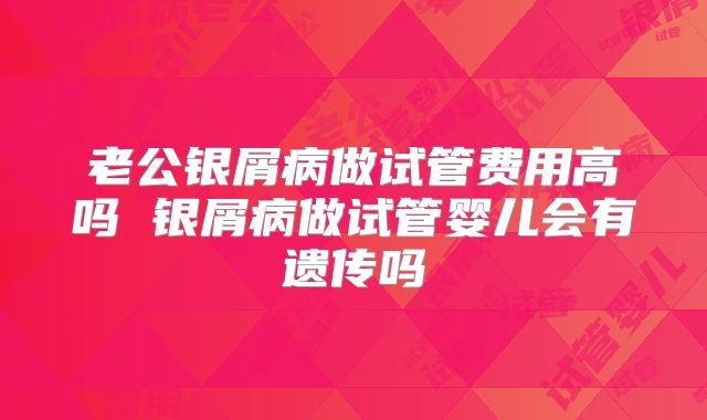 老公银屑病做试管费用高吗 银屑病做试管婴儿会有遗传吗