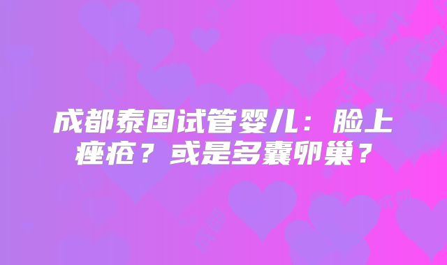 成都泰国试管婴儿：脸上痤疮？或是多囊卵巢？