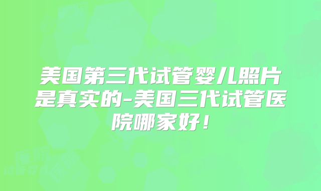 美国第三代试管婴儿照片是真实的-美国三代试管医院哪家好！