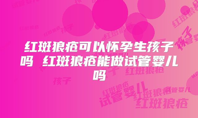 红斑狼疮可以怀孕生孩子吗 红斑狼疮能做试管婴儿吗
