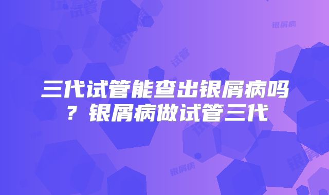 三代试管能查出银屑病吗？银屑病做试管三代