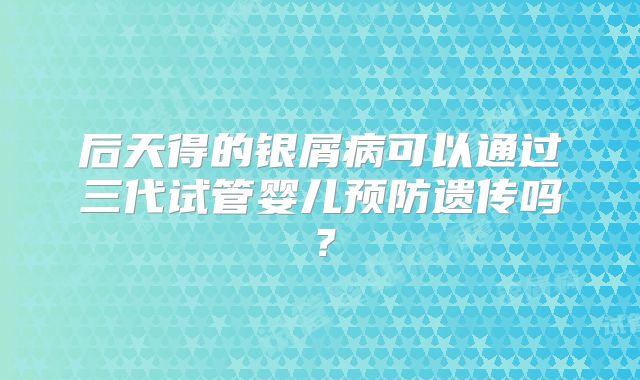后天得的银屑病可以通过三代试管婴儿预防遗传吗？