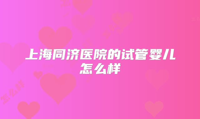 上海同济医院的试管婴儿怎么样