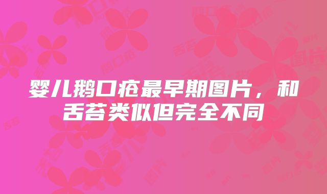 婴儿鹅口疮最早期图片，和舌苔类似但完全不同