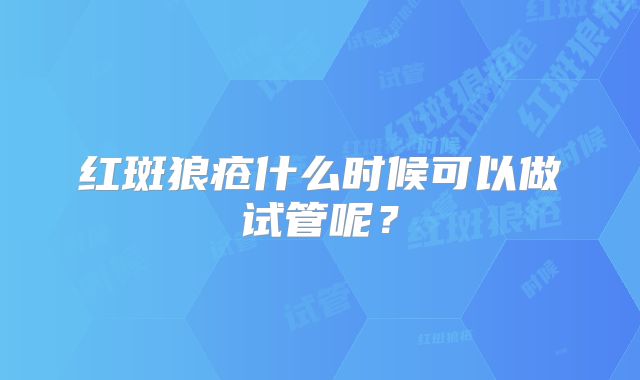 红斑狼疮什么时候可以做试管呢？