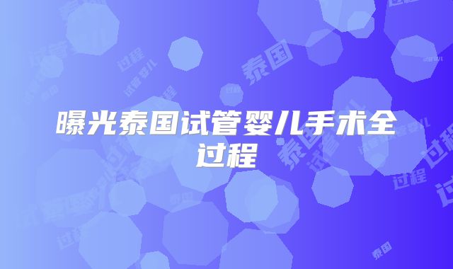 曝光泰国试管婴儿手术全过程