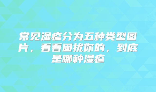常见湿疹分为五种类型图片,看看困扰你的,到底是哪种湿疹