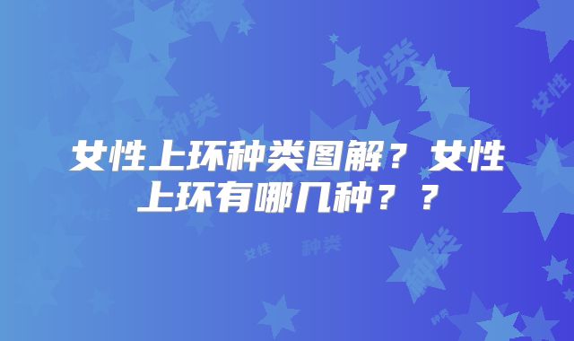 女性上环种类图解？女性上环有哪几种？？
