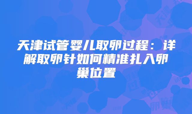 天津试管婴儿取卵过程：详解取卵针如何精准扎入卵巢位置