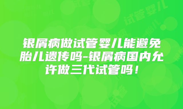 银屑病做试管婴儿能避免胎儿遗传吗-银屑病国内允许做三代试管吗！