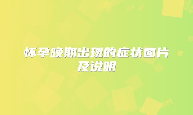 怀孕晚期出现的症状图片及说明