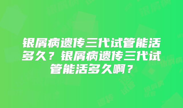 银屑病遗传三代试管能活多久？银屑病遗传三代试管能活多久啊？