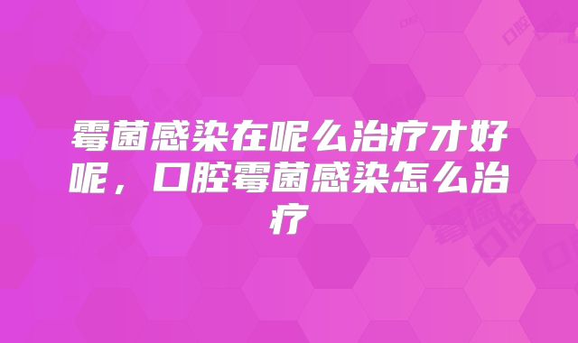 霉菌感染在呢么治疗才好呢,口腔霉菌感染怎么治疗