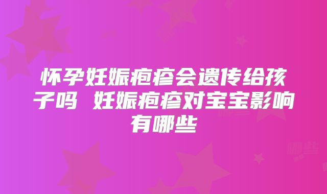 怀孕妊娠疱疹会遗传给孩子吗 妊娠疱疹对宝宝影响有哪些