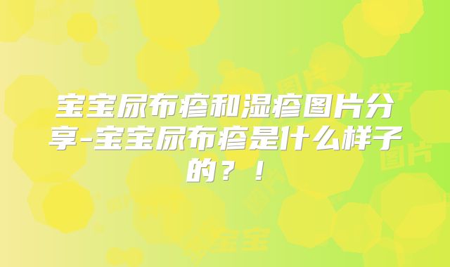 宝宝尿布疹和湿疹图片分享-宝宝尿布疹是什么样子的？！