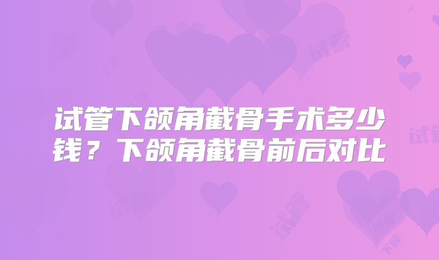 试管下颌角截骨手术多少钱?下颌角截骨前后对比