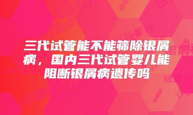 三代试管能不能筛除银屑病，国内三代试管婴儿能阻断银屑病遗传吗