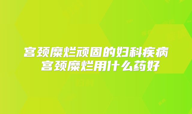 宫颈糜烂顽固的妇科疾病 宫颈糜烂用什么药好