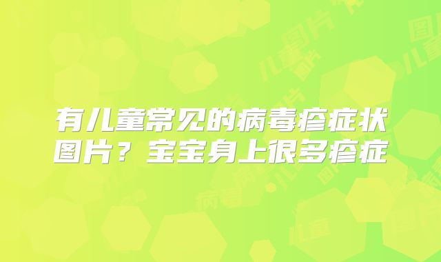 有儿童常见的病毒疹症状图片？宝宝身上很多疹症