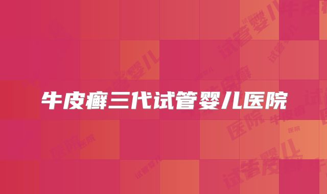 牛皮癣三代试管婴儿医院