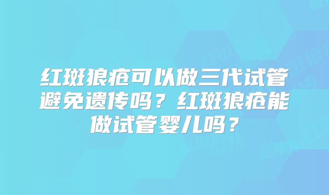 红斑狼疮可以做三代试管避免遗传吗？红斑狼疮能做试管婴儿吗？