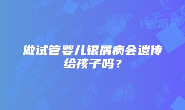 做试管婴儿银屑病会遗传给孩子吗？