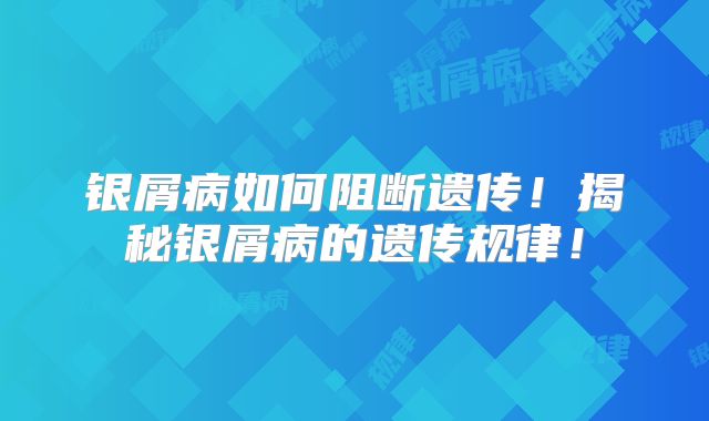 银屑病如何阻断遗传!揭秘银屑病的遗传规律!