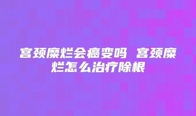 宫颈糜烂会癌变吗 宫颈糜烂怎么治疗除根