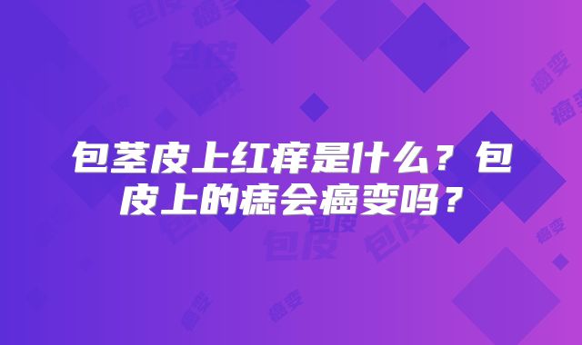包茎皮上红痒是什么？包皮上的痣会癌变吗？