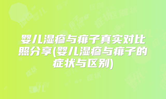 婴儿湿疹与痱子真实对比照分享(婴儿湿疹与痱子的症状与区别)