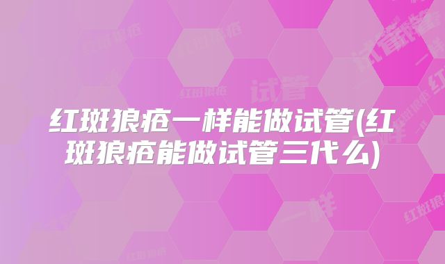 红斑狼疮一样能做试管(红斑狼疮能做试管三代么)