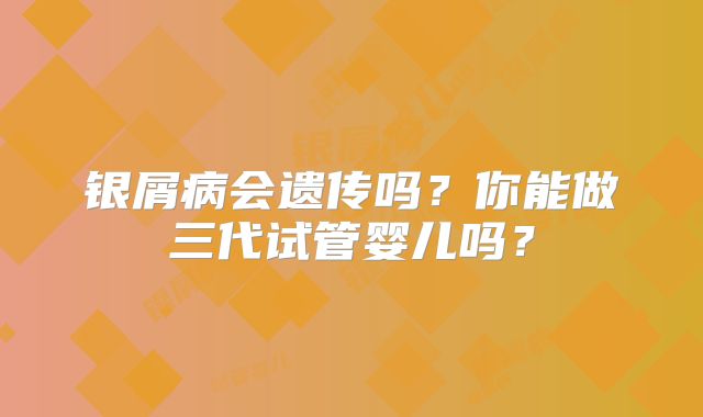银屑病会遗传吗？你能做三代试管婴儿吗？