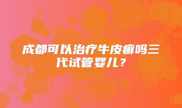 成都可以治疗牛皮癣吗三代试管婴儿？