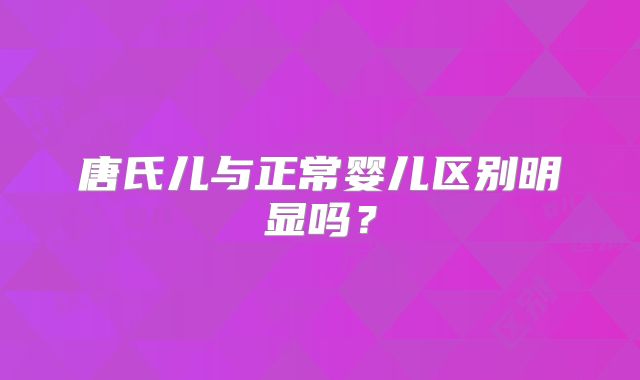唐氏儿与正常婴儿区别明显吗?