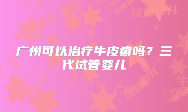 广州可以治疗牛皮癣吗？三代试管婴儿