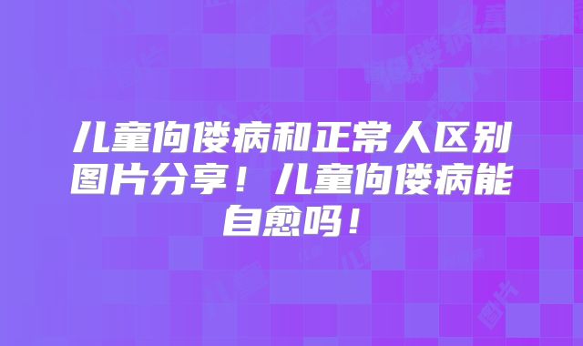 儿童佝偻病和正常人区别图片分享！儿童佝偻病能自愈吗！