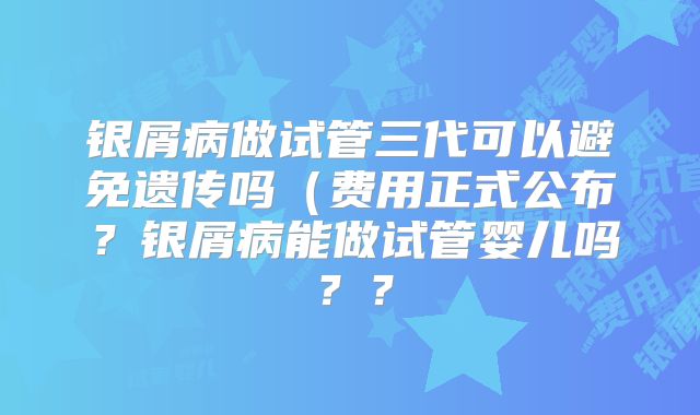 银屑病做试管三代可以避免遗传吗(费用正式公布?银屑病能做试管婴儿吗??