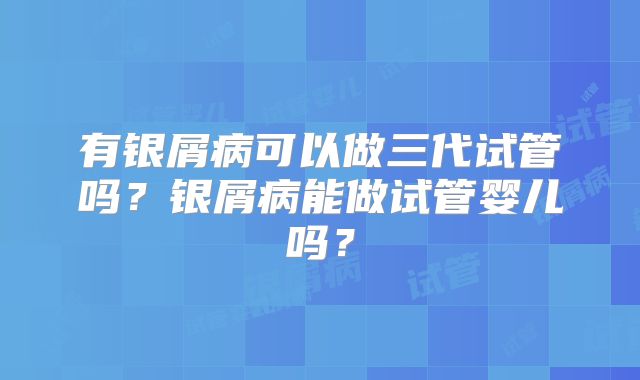有银屑病可以做三代试管吗?银屑病能做试管婴儿吗?