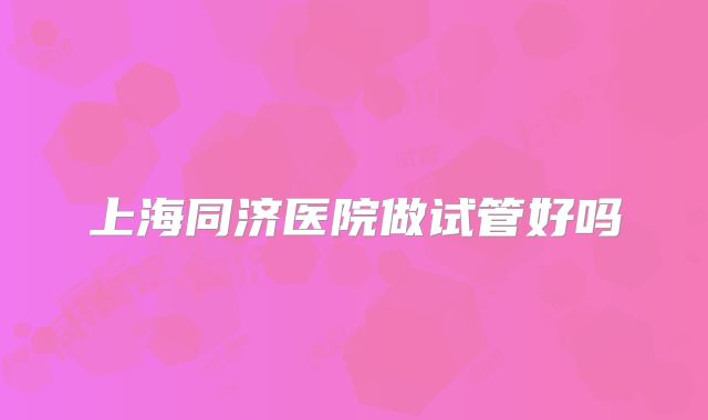 上海同济医院做试管好吗