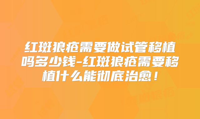 红斑狼疮需要做试管移植吗多少钱-红斑狼疮需要移植什么能彻底治愈！