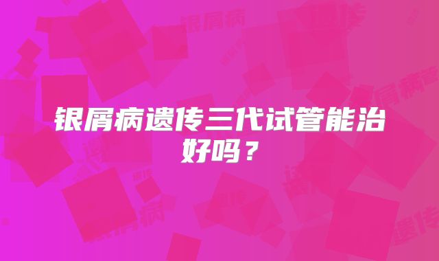银屑病遗传三代试管能治好吗？