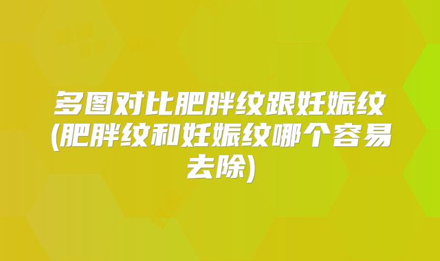 多图对比肥胖纹跟妊娠纹(肥胖纹和妊娠纹哪个容易去除)