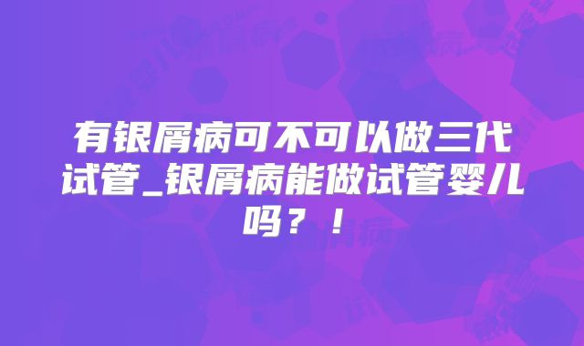 有银屑病可不可以做三代试管_银屑病能做试管婴儿吗？！