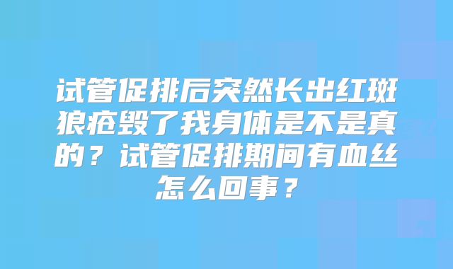试管促排后突然长出红斑狼疮毁了我身体是不是真的?试管促排期间有血丝怎么回事?