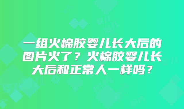 一组火棉胶婴儿长大后的图片火了？火棉胶婴儿长大后和正常人一样吗？