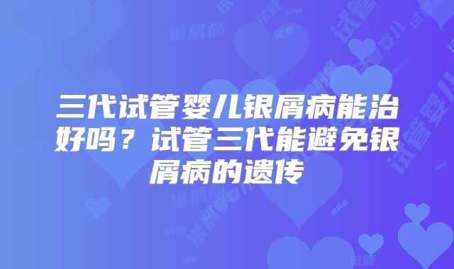 三代试管婴儿银屑病能治好吗？试管三代能避免银屑病的遗传