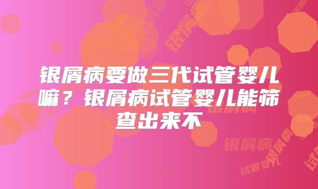 银屑病要做三代试管婴儿嘛？银屑病试管婴儿能筛查出来不