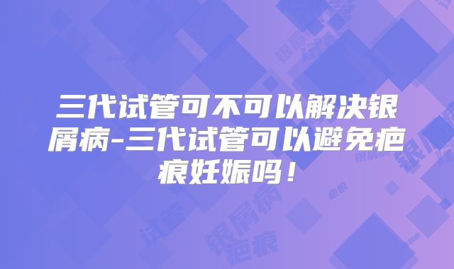 三代试管可不可以解决银屑病-三代试管可以避免疤痕妊娠吗！